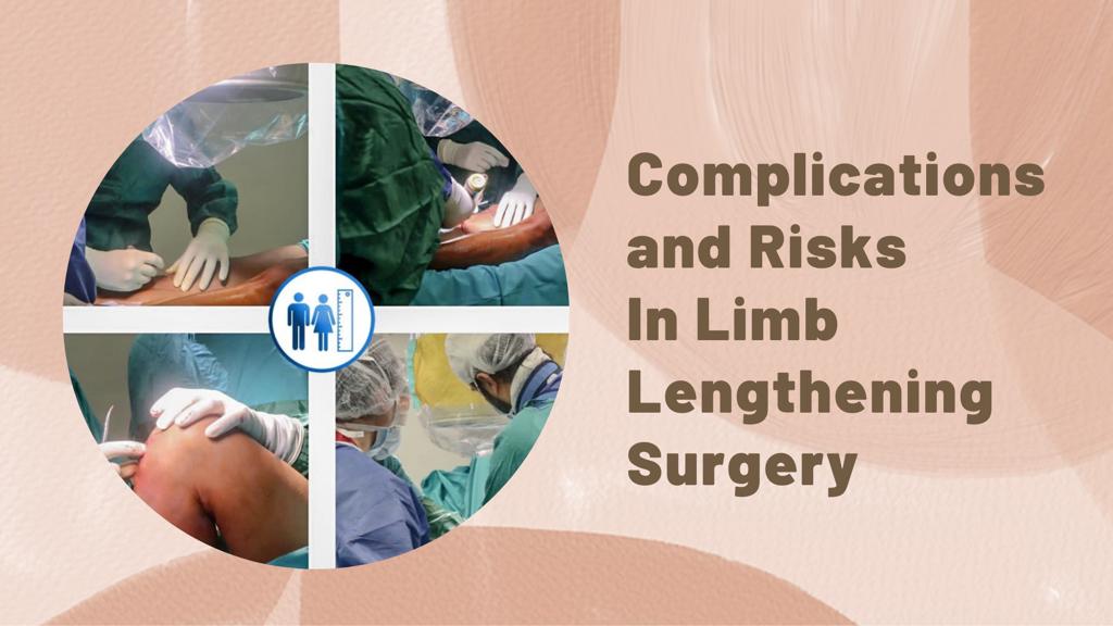 Complications and Risks in Limb Lengthening Surgery